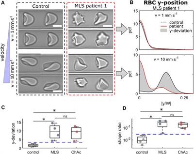 Erysense, a Lab-on-a-Chip-Based Point-of-Care Device to Evaluate Red Blood Cell Flow Properties With Multiple Clinical Applications